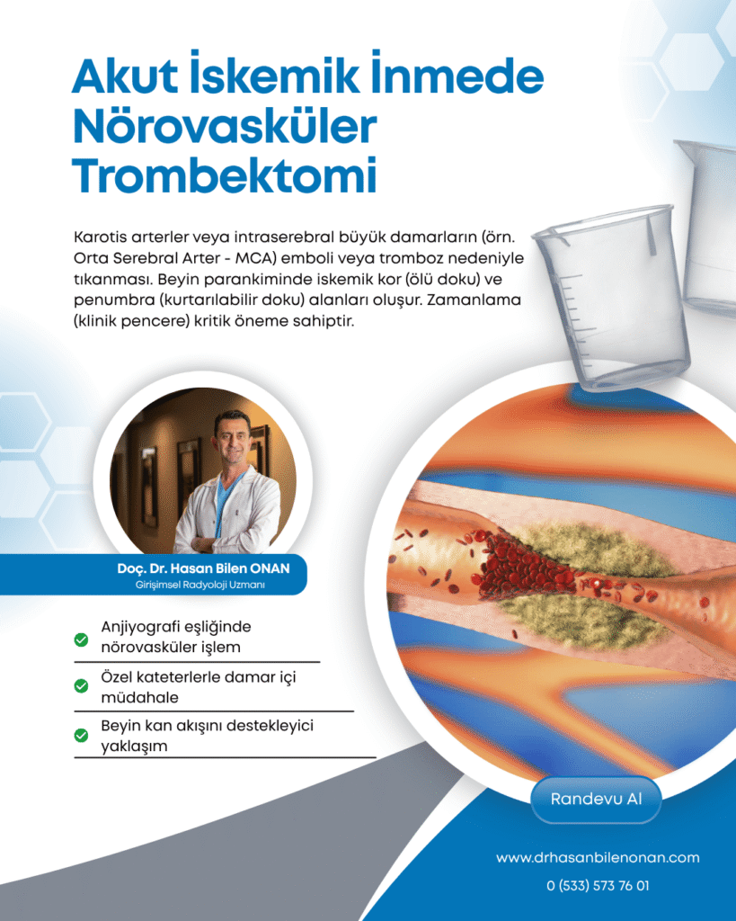 Akut İskemik İnmede Nörovasküler Trombektomi