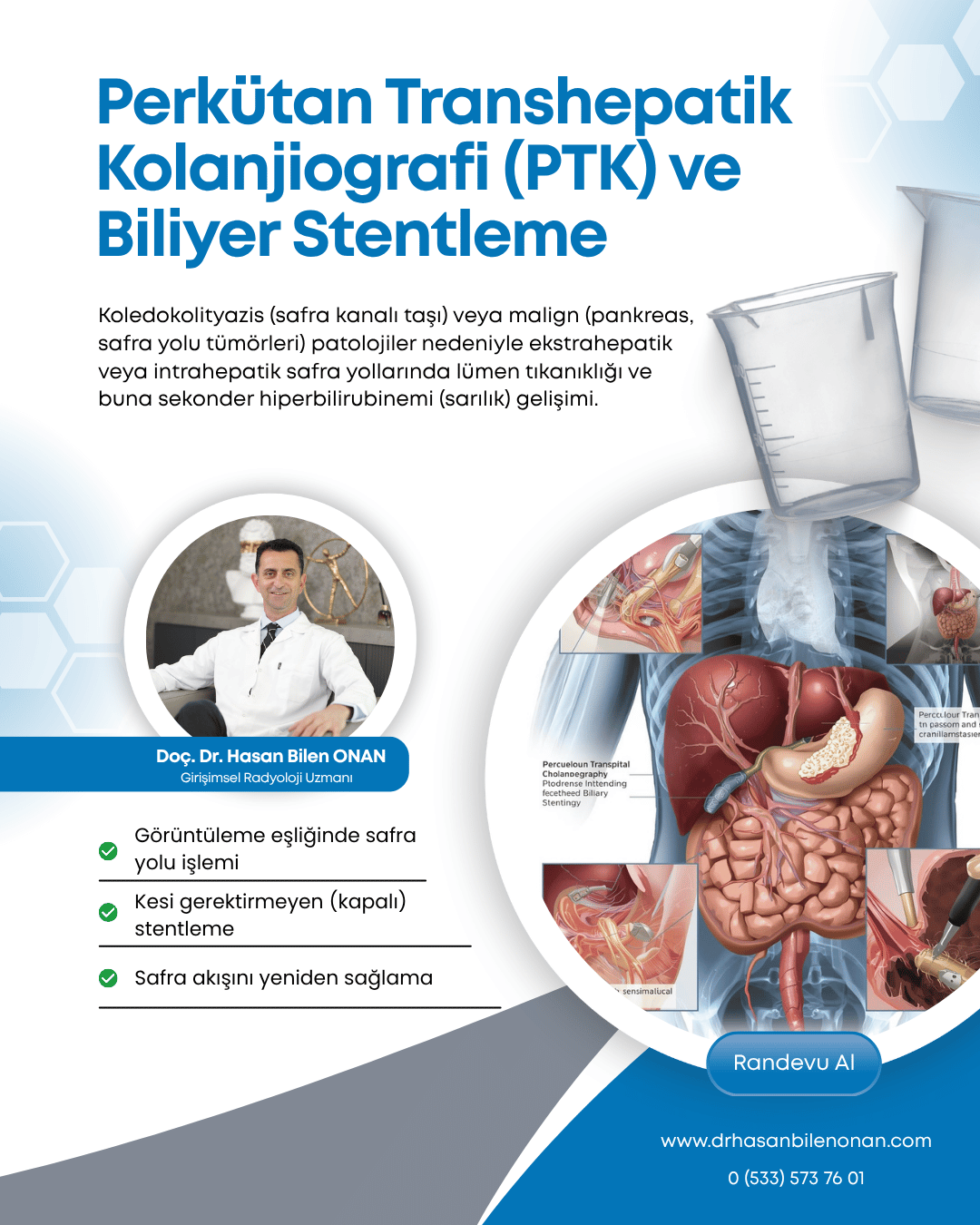 Perkütan Transhepatik Kolanjiografi (PTK) ve Biliyer Stentleme