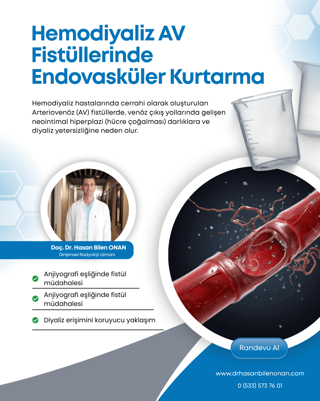 Hemodiyaliz AV Fistüllerinde Endovasküler Kurtarma