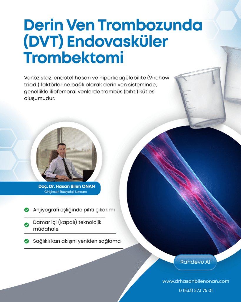 Derin Ven Trombozunda (DVT) Endovasküler Trombektomi