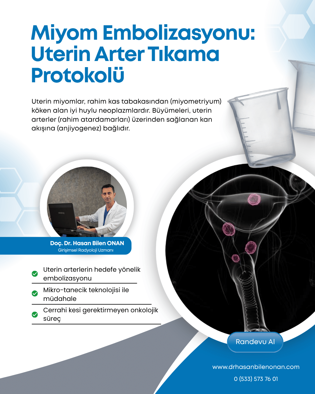 Miyom Embolizasyonu: Uterin Arter Tıkama Protokolü
