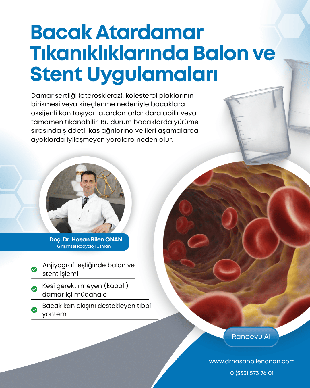 Bacak Atardamar Tıkanıklıklarında Balon ve Stent Uygulamaları