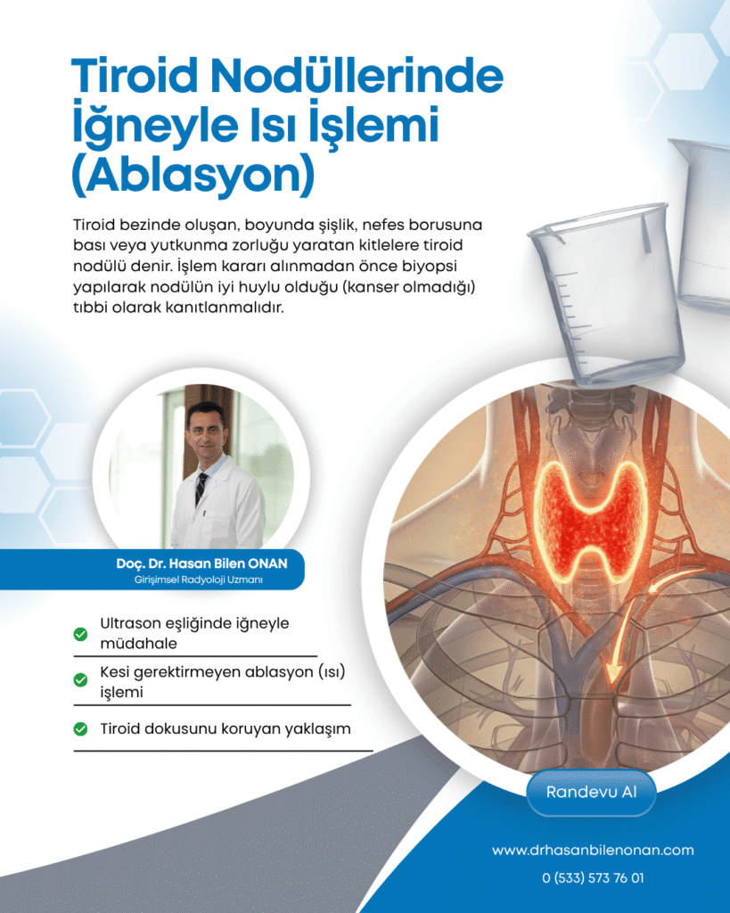 Tiroid Nodüllerinde Perkütan Termal Ablasyon