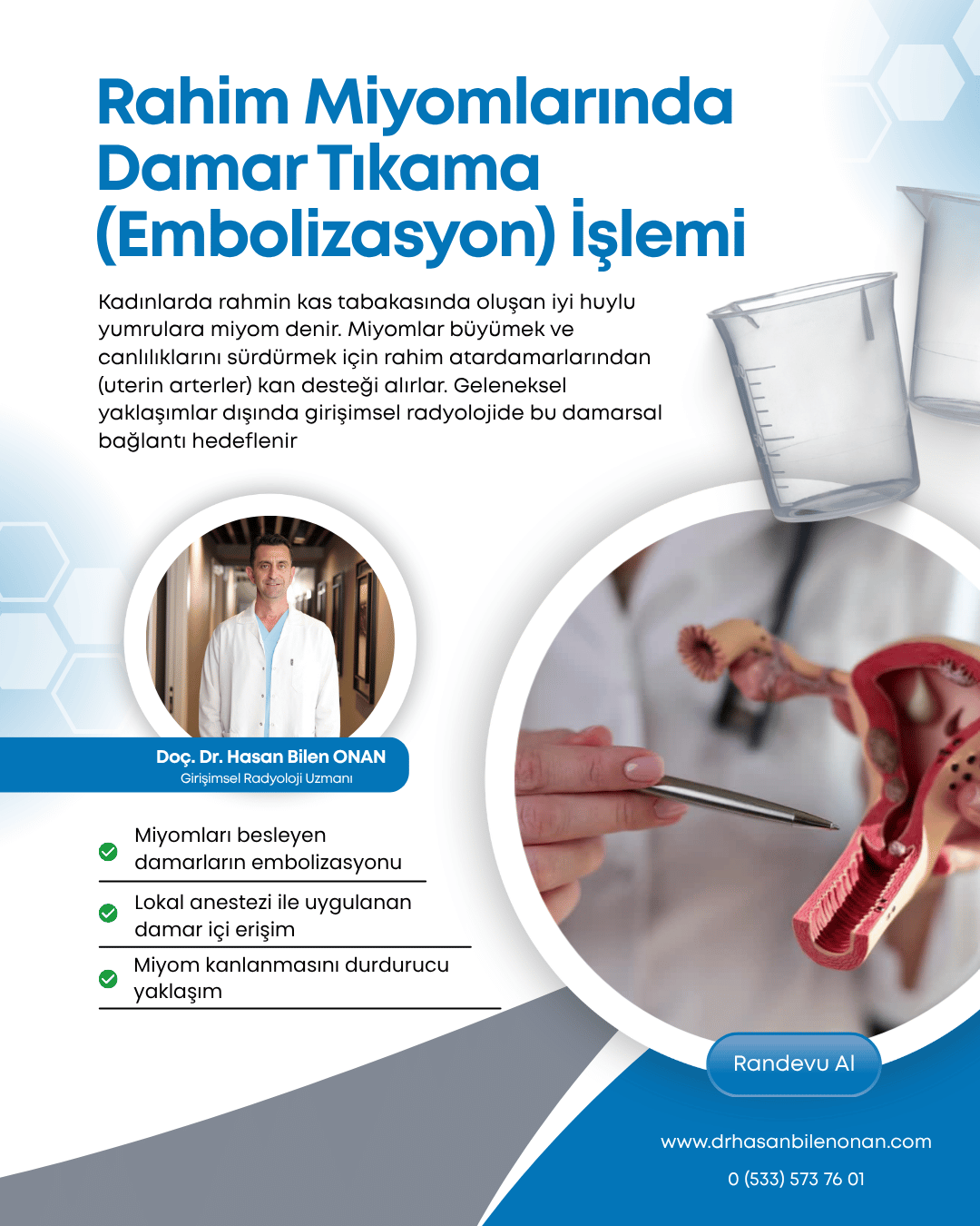 Rahim Miyomlarında Damar Tıkama (Embolizasyon) İşlemi