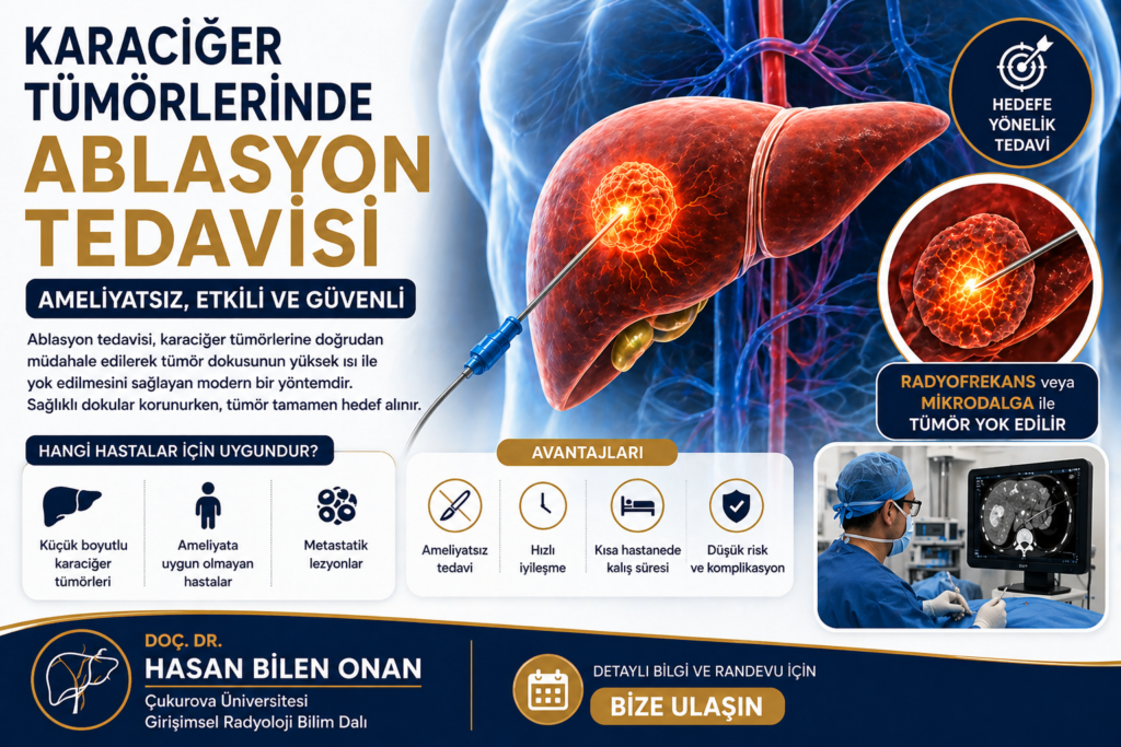 Karaciğer Tümörlerinde Ablasyon Tedavisi