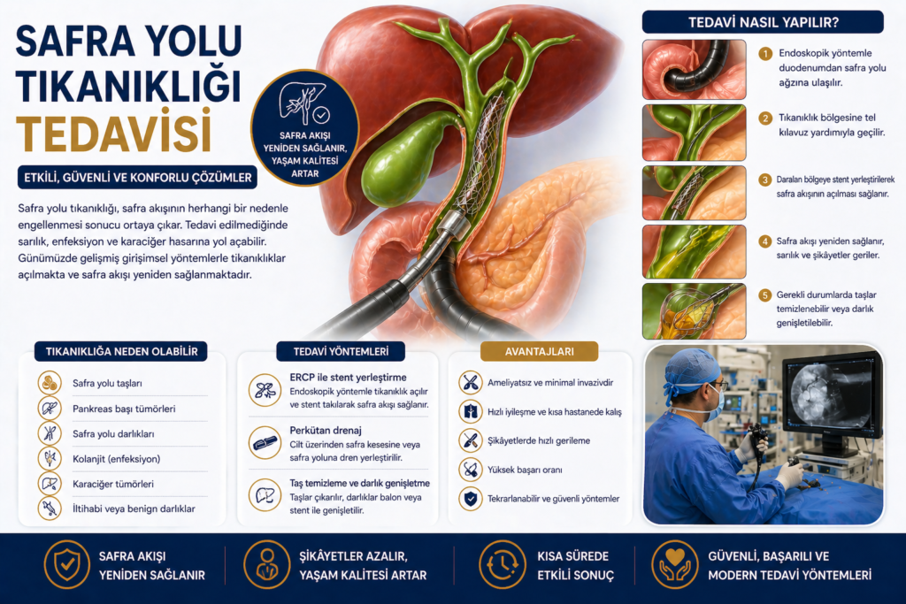 Safra Yolu Tıkanıklığı Tedavisi