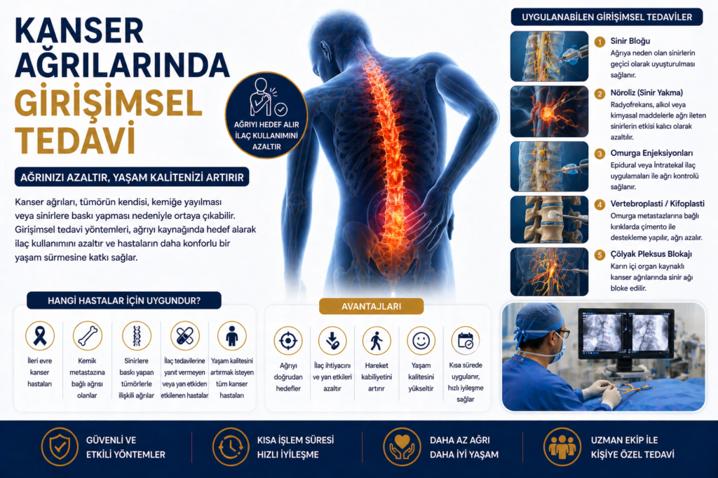 Kanser Ağrılarında Girişimsel Tedavi